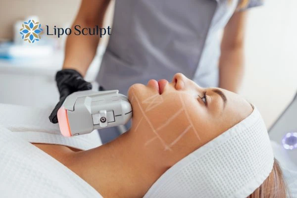HIFU vs Botulinum Toxin: Understanding the Differences 1 HIFU vs Botox St Albans What is the best option for you?