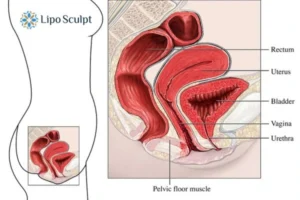 Treatment For A Leaky Bladder 2 How EM Chair treatment St Albans can help Leaky bladder issues. Read more now!