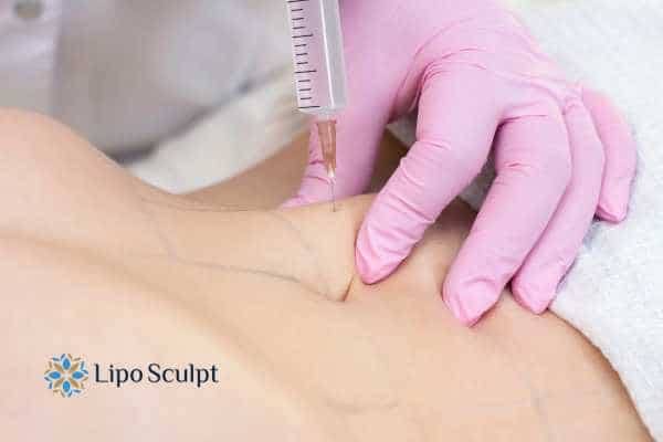 Aqualyx for Muffin Tops: What to Know Before Fat-Dissolving Injections 4 Are there risks St Albans?