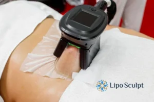 Does Fat Freezing At Home Work? 3 Fat freezing at home from Lipo Sculpt St Albans